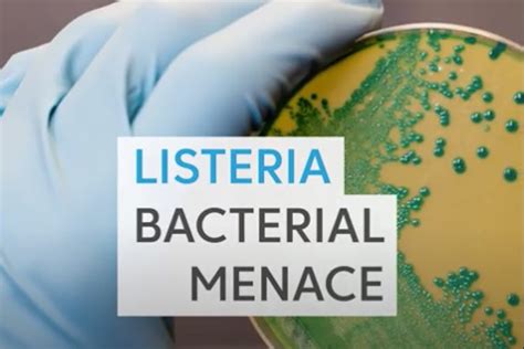 ¿Listeria: Una aventura microbiana que te hará repensar tu cena?